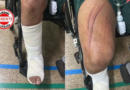 Garoto de Programa Salta de Prédio para Escapar de Casal Armado em Rio Verde​
