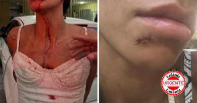 Mulher acusa atacante do Vila Nova de agressão em bar no Rio; jogador nega envolvimento