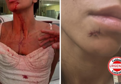 Mulher acusa atacante do Vila Nova de agressão em bar no Rio; jogador nega envolvimento