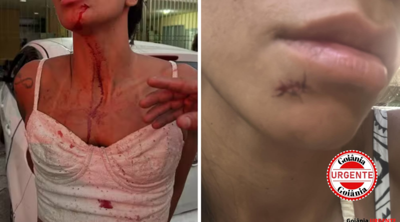 Mulher acusa atacante do Vila Nova de agressão em bar no Rio; jogador nega envolvimento