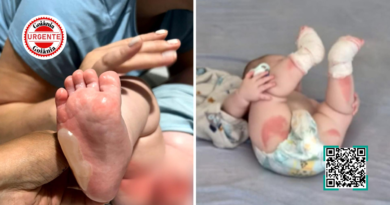 Bebê sofre queimaduras graves durante banho em berçário e caso expõe falhas críticas de segurança, em Rio Verde