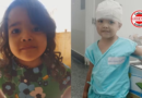 Menina de 4 anos é atacada por pit bull e fica internada em hospital de Goiânia