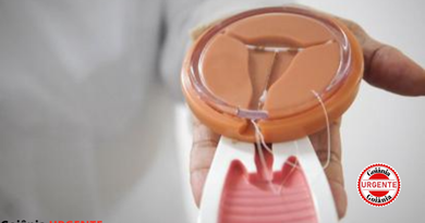 Planos de saúde terão de cobrir DIU hormonal para casos de endometriose